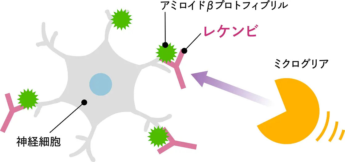 レケンビ